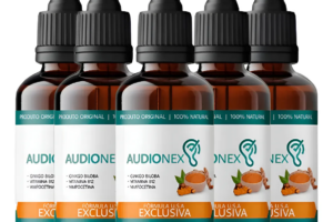 Audionex Para Que Serve
